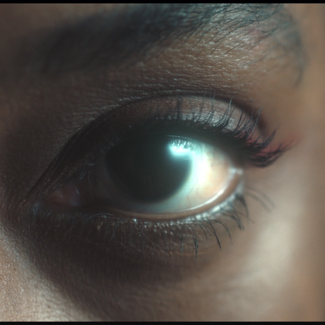 Eye / Veiling Glare